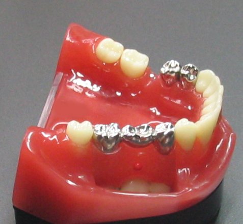 Zahnersatz Zahnarztpraxis Sonja Kruger